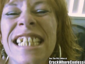 Donkey Teeth Red Head Mom Crack Slut