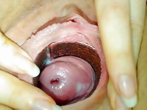 Shy Cervix