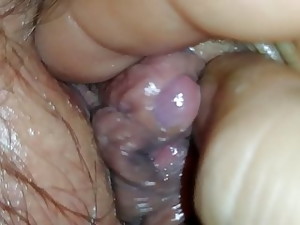 Klitoris besar, Memek wanita